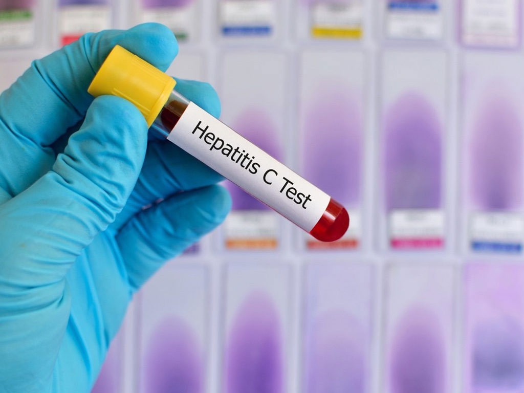 Hepatite virale