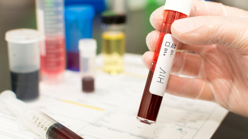 Strategia privind persoanele cu HIV/SIDA, în dezbatere la Ministerul Sănătății