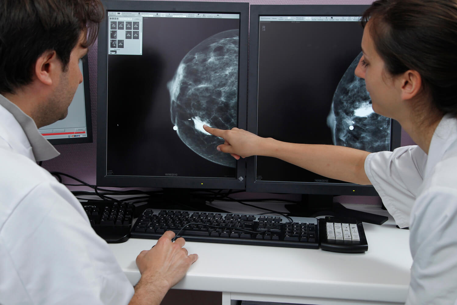 Studiu. Mamografiile scad cu 60% riscul de deces în urma cancerului de sân