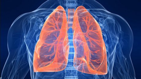 Tratamente cheie împotriva cancerului pulmonar