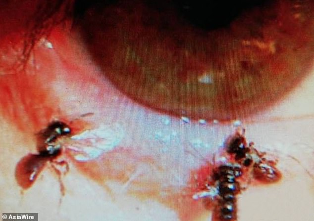 Au găsit patru albine în ochiul pentru femei. Insectele se hrăneau cu lacrimi