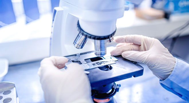 Alternativa la biopsie. Un mic dispozitiv portabil ar putea captura celule cancerigene direct din fluxul sanguin