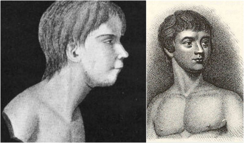 Cazul lui Victor of Aveyron, copilul sălbatic care vorbea limba lupilor