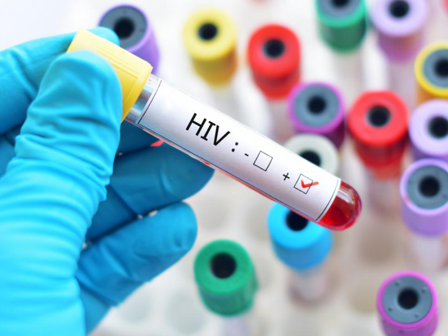 506 cazuri noi de infecţie cu HIV, în 2019