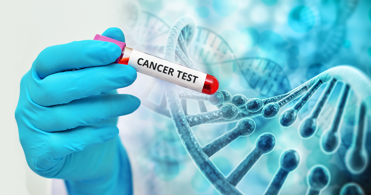 Testul care poate detecta 50 de tipuri de cancer