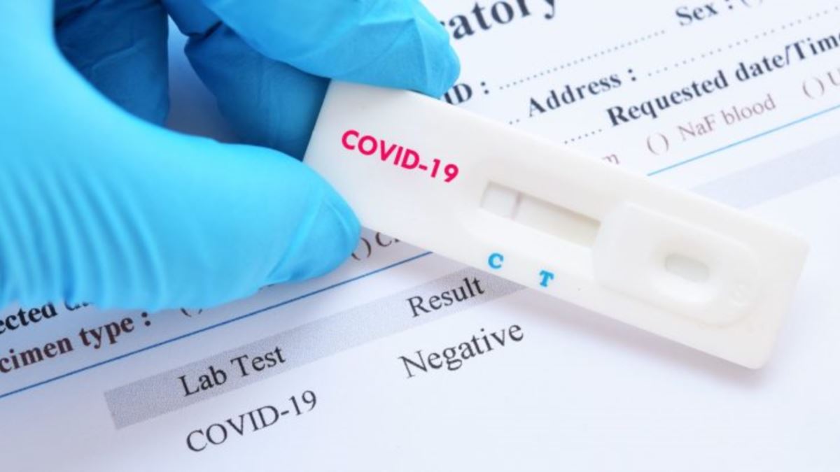 Test COVID-19