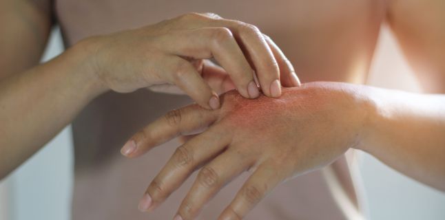 Psoriazisul. Factori declanșatori, simptome, tipuri
