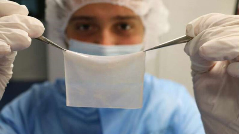 Primele teste pentru grefa de piele obținută cu imprimante 3D: ”O unealtă terapeutică foarte puternică”