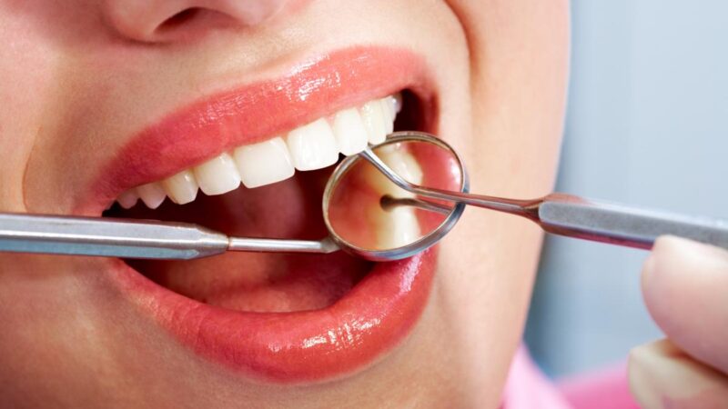 Care sunt cauzele sângerării gingiilor
