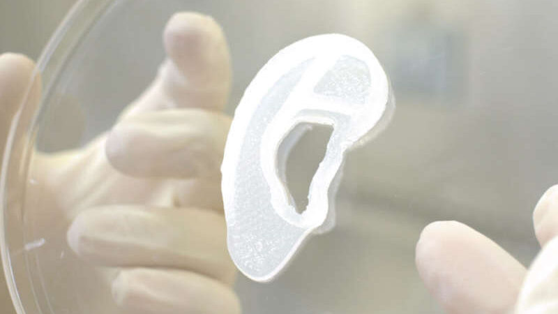 Premieră mondială. Implant de ureche imprimată 3D pe bază de celule umane
