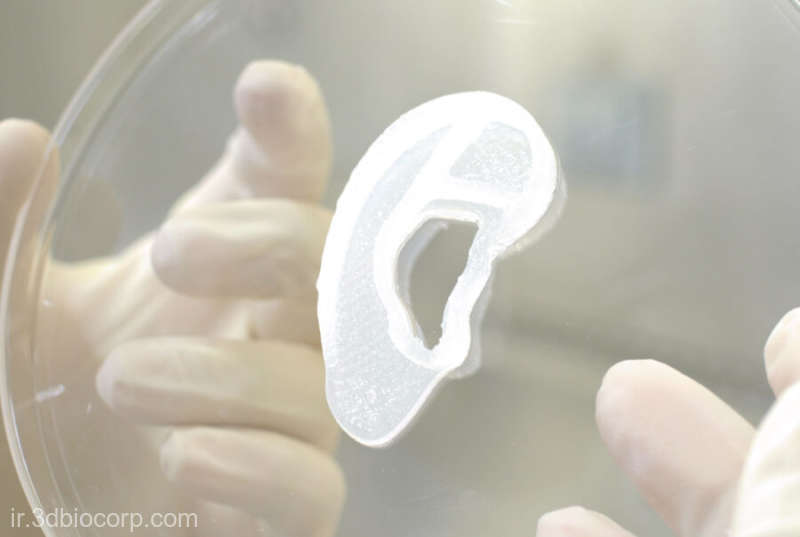 Premieră mondială. Implant de ureche imprimată 3D pe bază de celule umane