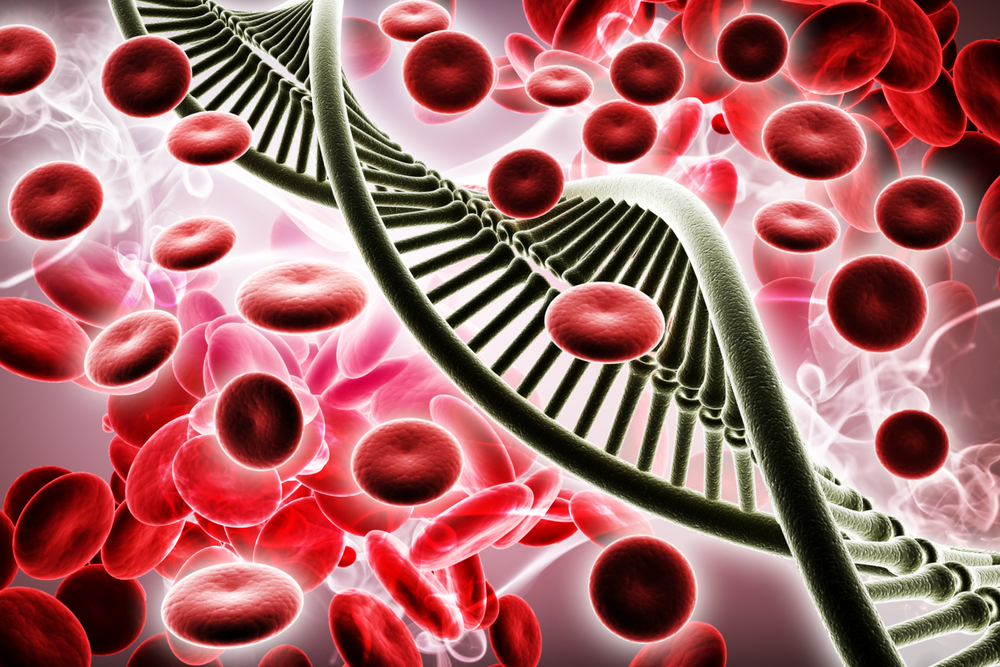 Grupa de sânge este legată de un risc mai mare de accident vascular cerebral cu debut precoce