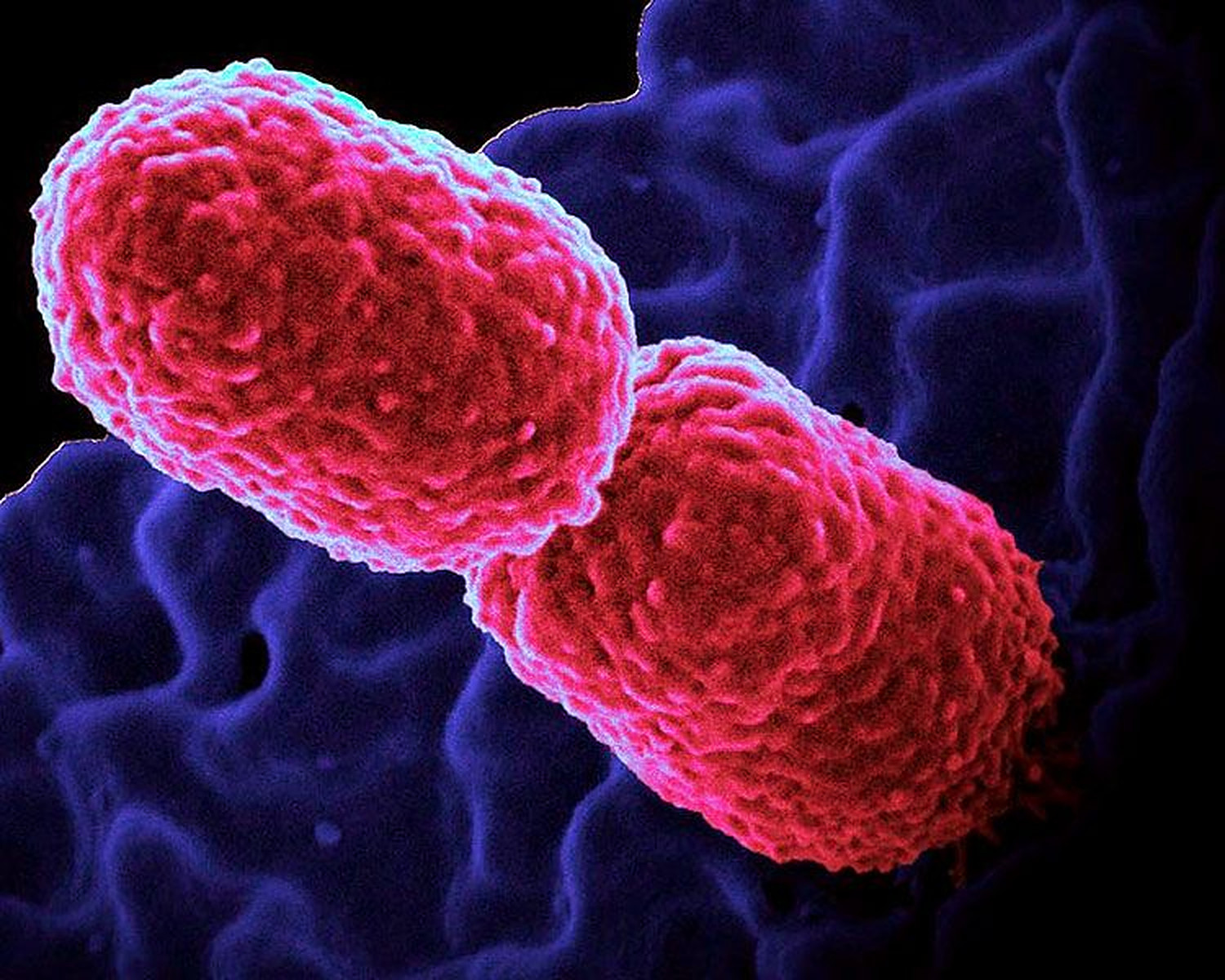 Cercetătorii au identificat o bacterie intestinală care poate reduce unele dintre riscurile asociate fumatului