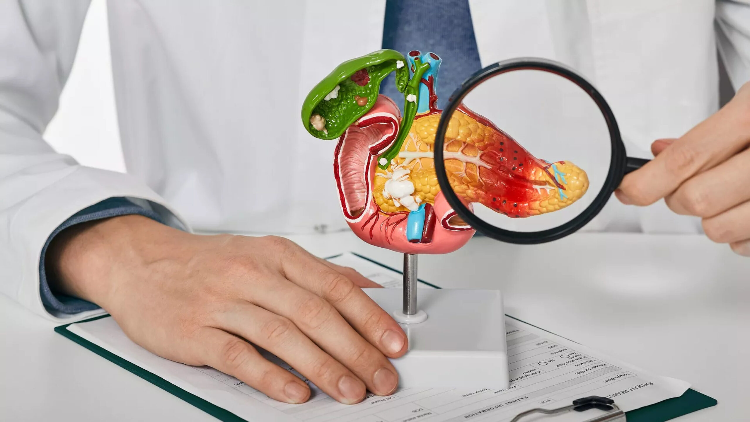 Pancreatita: Cauze, simptome, complicații